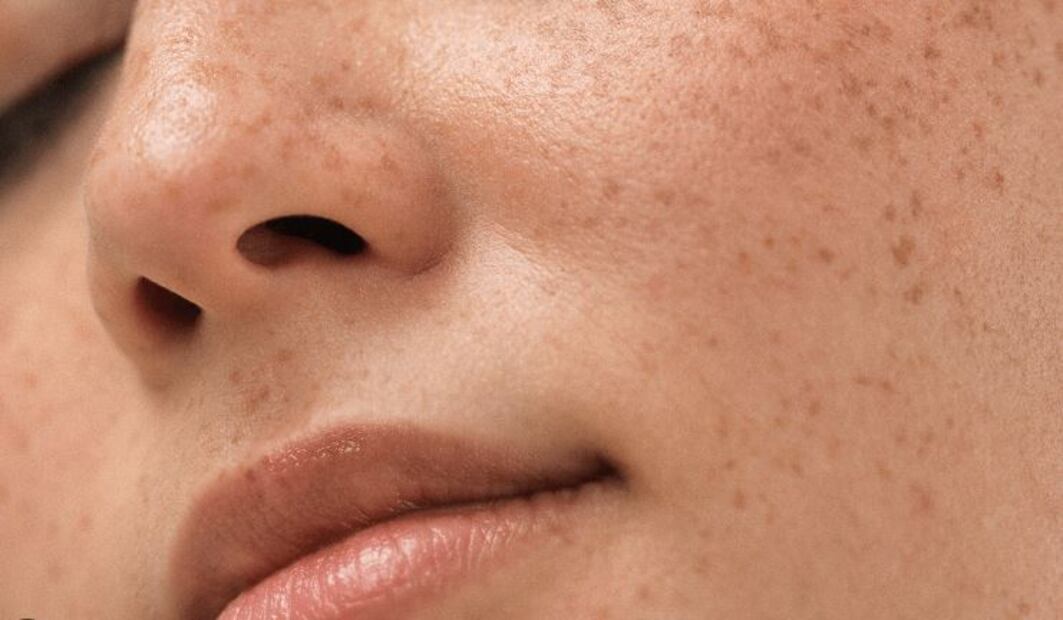 3 factores por los que salen las manchas de sol
Foto: Captura de pantalla