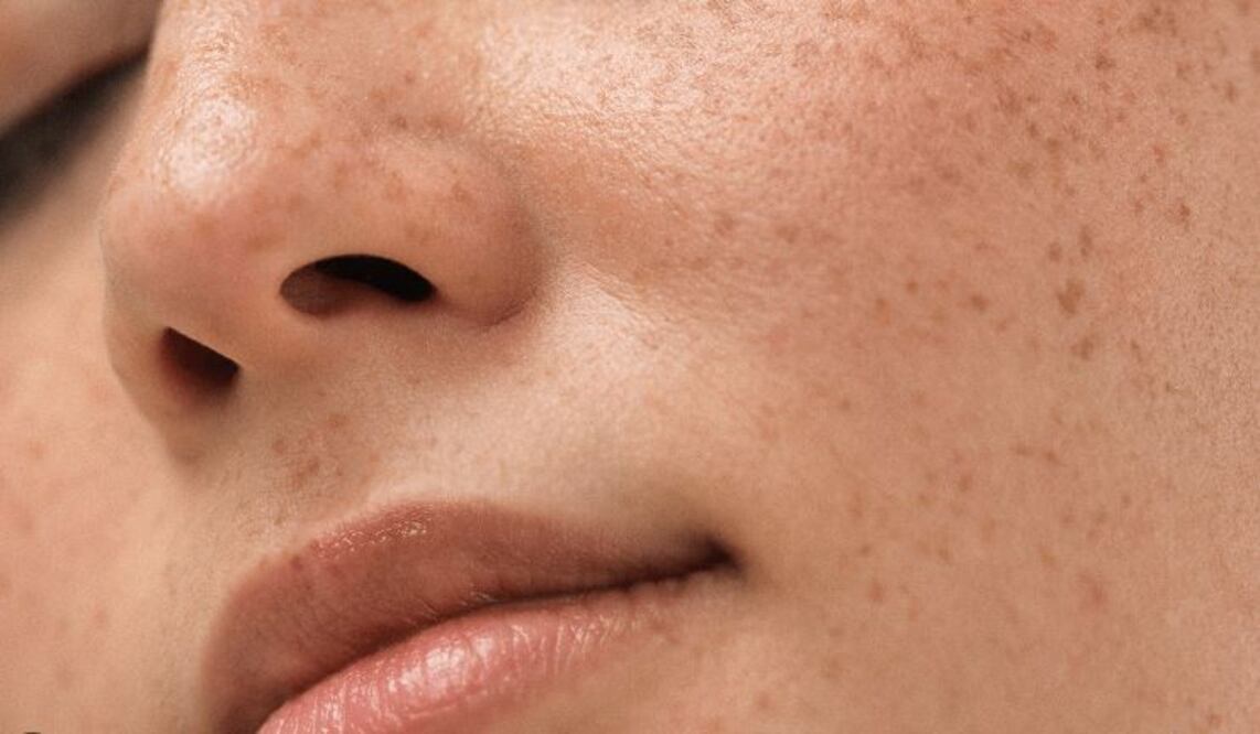 3 factores por los que salen las manchas de sol
Foto: Captura de pantalla