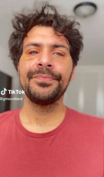 El actor mostró las lesiones que los asaltantes le provocaron en el rostro   Foto: Tik Tok