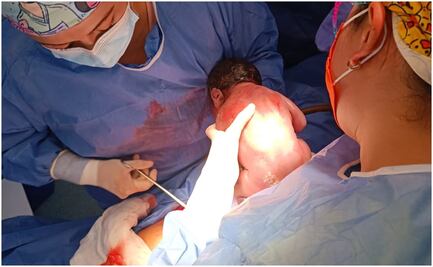 ¡Fue niño! Primer bebé del 2024 en CDMX nació en Hospital Materno Infantil