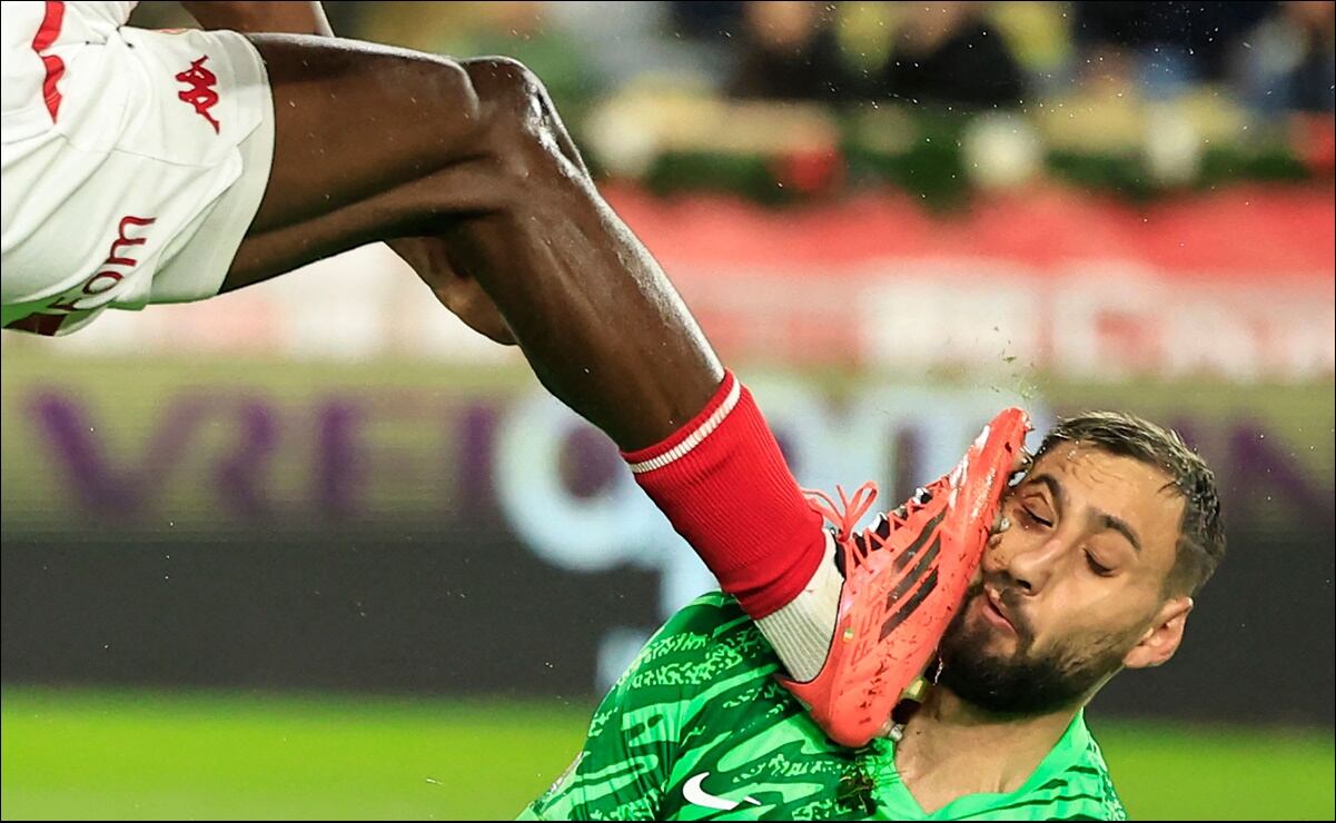 Donnarumma Suffers Facial Injuries After Being Hit in the Face