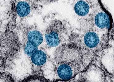 Covid-19: La secadora de manos propaga el coronavirus, dice estudio