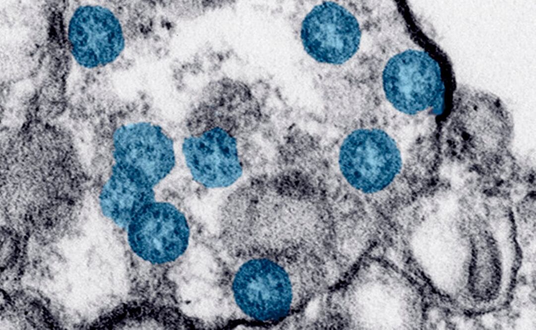 Foto: Hannah A. Bullock, Azaibi Tamin/CDC via AP, archivo