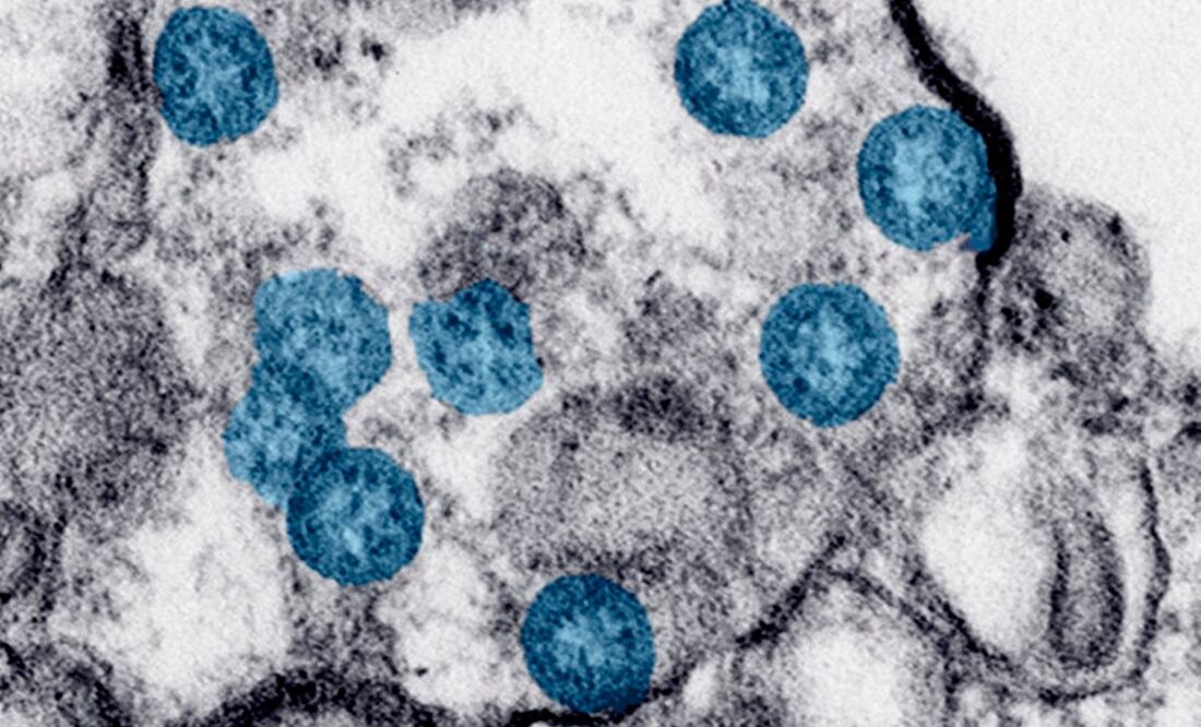 Foto: Hannah A. Bullock, Azaibi Tamin/CDC via AP, archivo