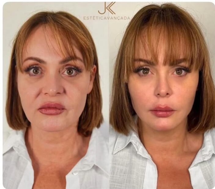 La actriz Gaby Spanic comparte el antes y el después de su rostro tras someterse a varios procedimientos estéticos.