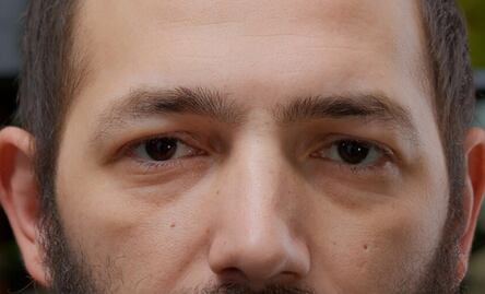 ¿Cuál es la vitamina ideal para eliminar las bolsas de los ojos?