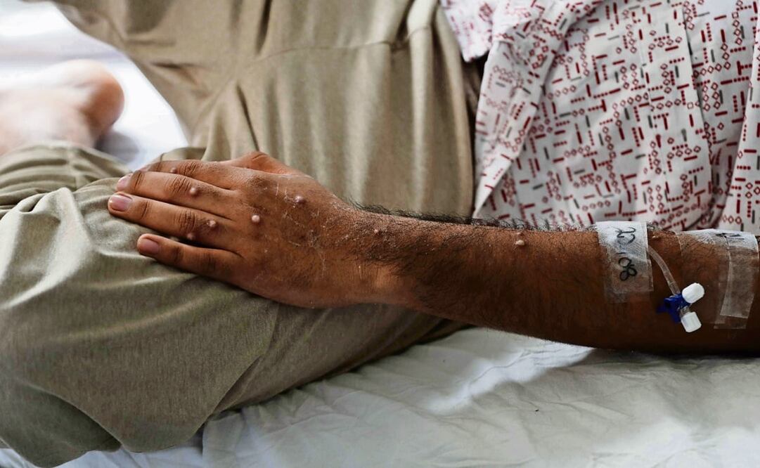 Foto: EFE/ Paolo Aguilar