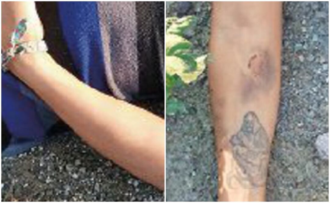 La víctima tenía un tatuaje de la Santa Muerte en el brazo. (Fotografía: Especial )