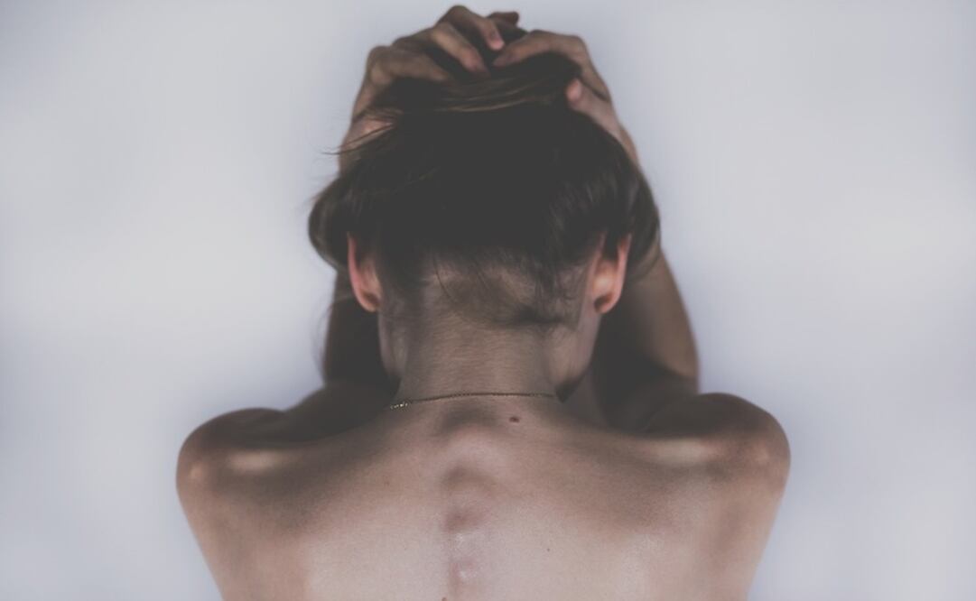 Cirujanos extrajeron una bola de pelo del peso de un ladrillo del estómago de una adolescente. Foto Ilustrativa: Pixabay 