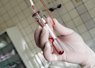 Drug buying plan leaves hundreds without HIV treatment in Mexico