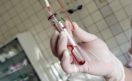 Drug buying plan leaves hundreds without HIV treatment in Mexico