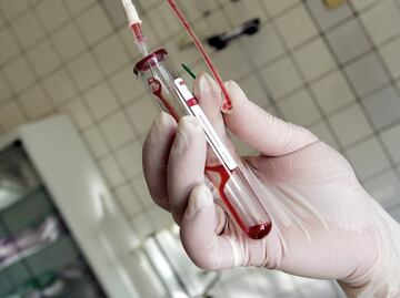 Drug buying plan leaves hundreds without HIV treatment in Mexico