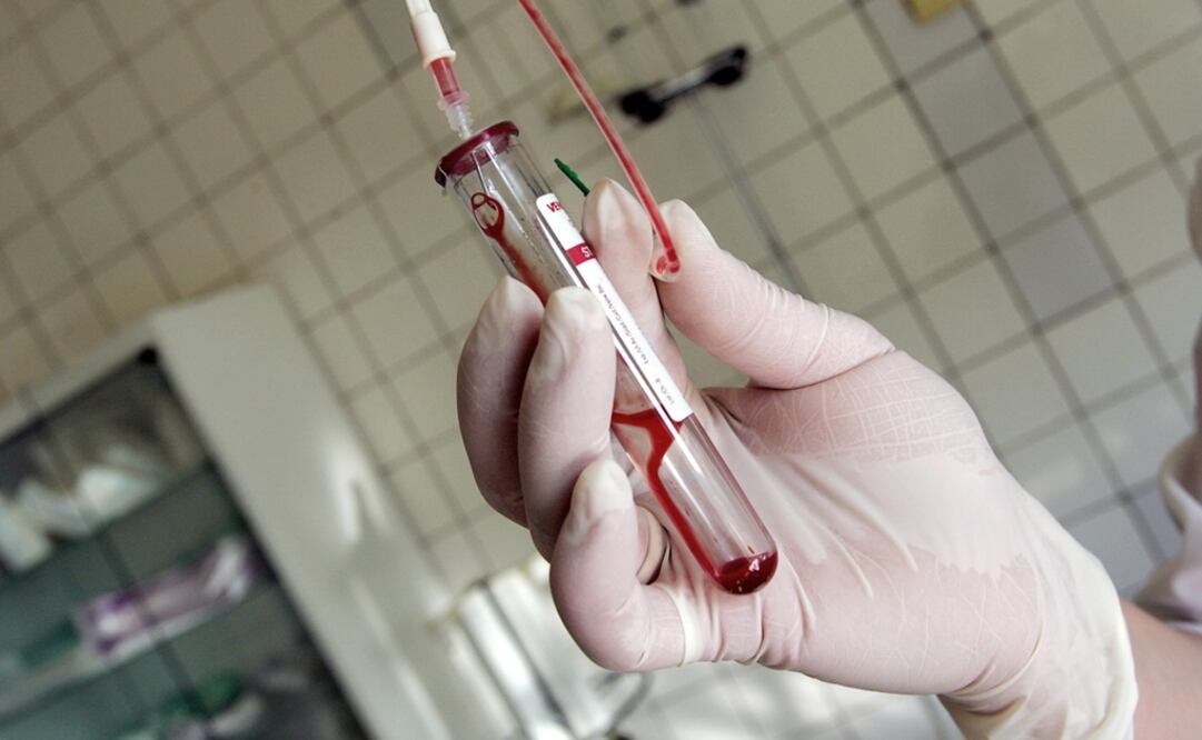 The shortage is a serious concern in a country where, as of 2016, there were some 220,000 people living with the disease, according to the United Nations - Photo: Maxim Marmur/AFP