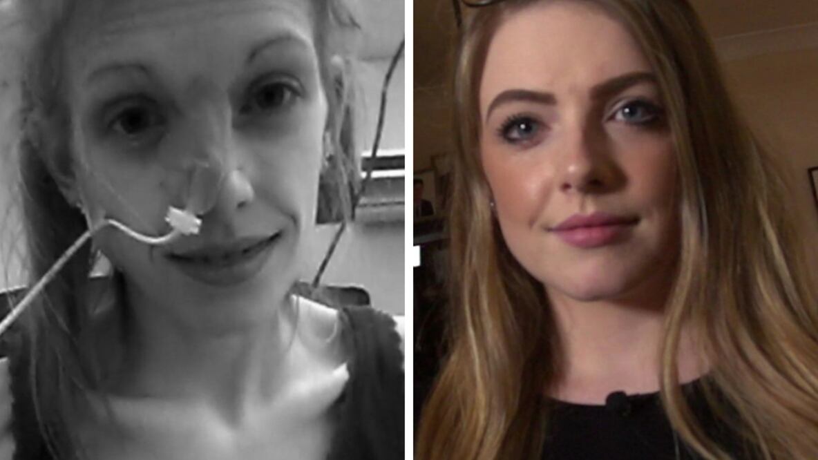 Jodie-Leigh Neil, ahora recuperada, dice que Instagram fomentó su desorden alimenticio. Foto: BBC