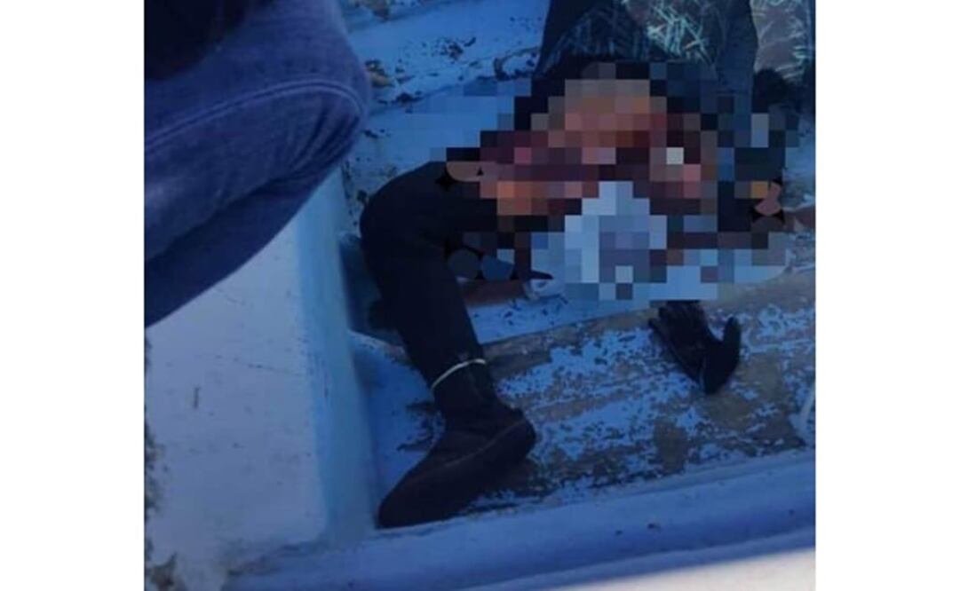 Imagen de la víctima atacada pro el tiburón. (Foto: especial)