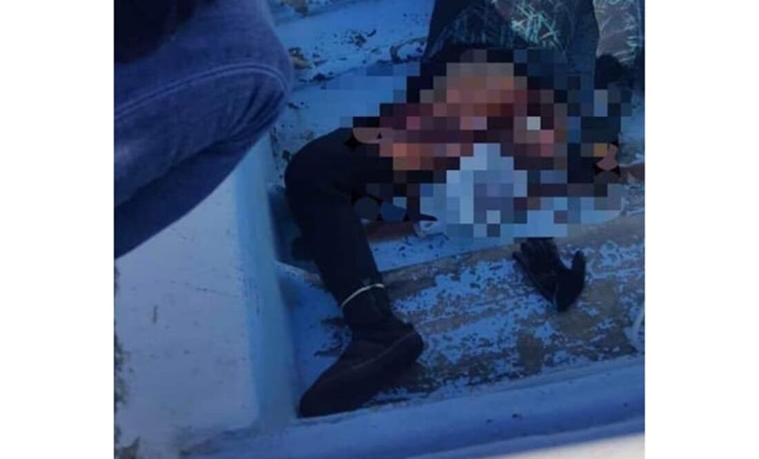 Imagen de la víctima atacada pro el tiburón. (Foto: especial)