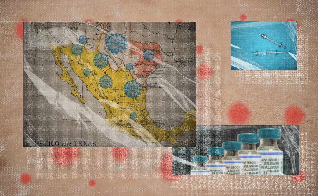 Sarampión| Imagen: Angélica Vázquez