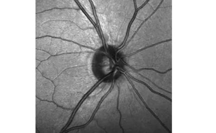 Descubren células madre en el nervio óptico