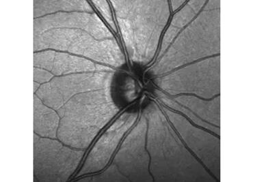 Descubren células madre en el nervio óptico