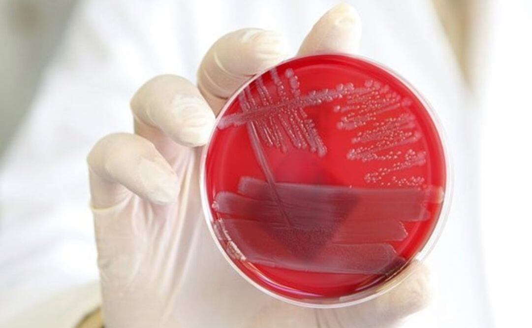 Una muestra de Escherichia coli enterohemorrágica. Foto: EFE