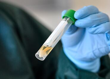 Confirman brote de coronavirus en Hospital Civil de Ciudad Victoria