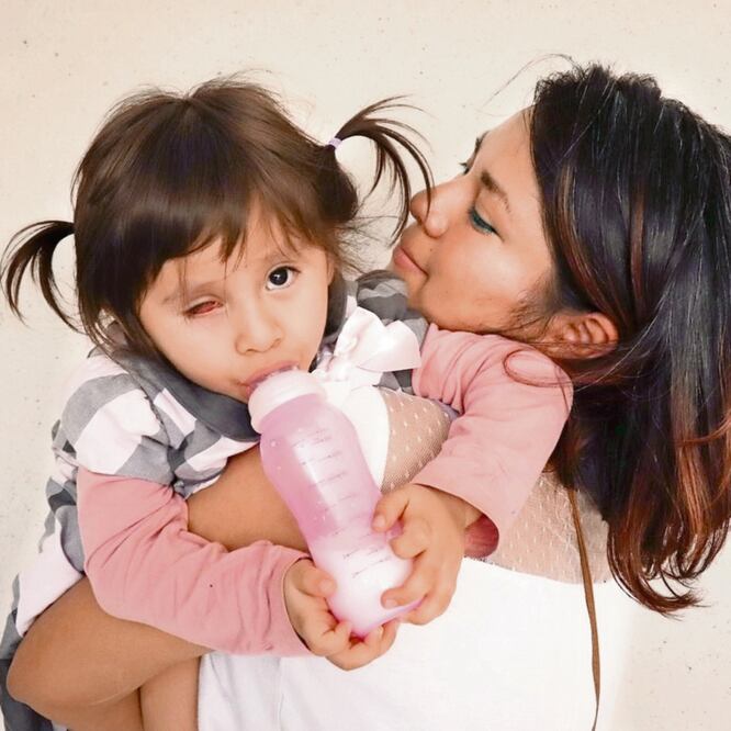 Especialistas recomiendan a los padres de Ximena un costoso tratamiento, que le permitirá conservar la vista de su único ojo. ESPECIAL