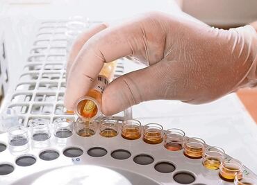 Proponen antidoping para funcionarios