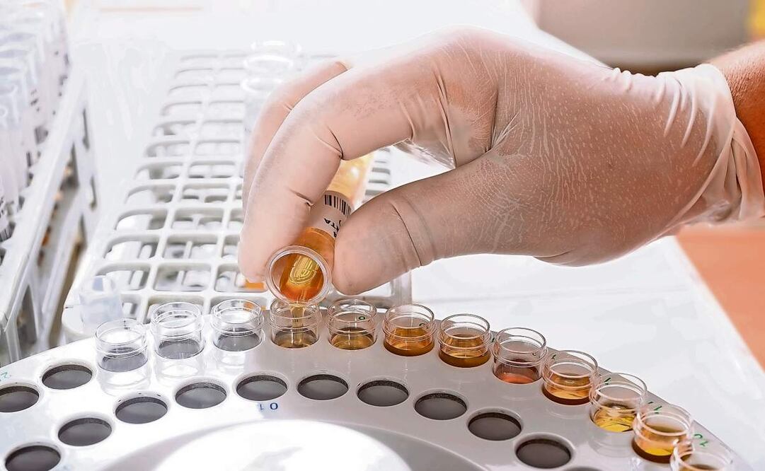 El examen toxicológico consiste en el análisis químico de muestras de orina o sangre para identificar la presencia de drogas. Foto: Especial