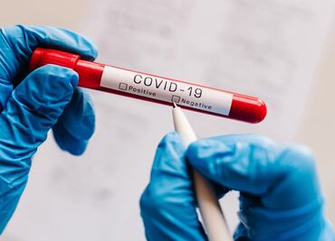 Usan pruebas falsas de Covid-19 para poder viajar a otros países