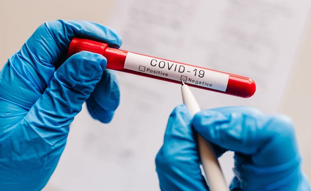 Se han presentado casos de pruebas falsas en Francia y Brasil. Foto: iStock