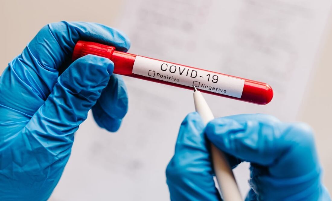 Se han presentado casos de pruebas falsas en Francia y Brasil. Foto: iStock