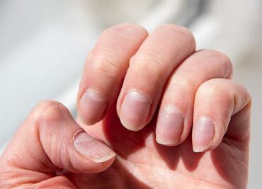 Por qué no debes morderte las uñas