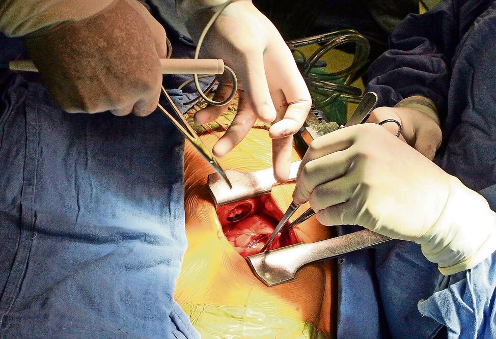 Las válvulas cardiacas se encuentran en los conductos de salida de las cuatro cavidades del corazón, donde cumplen la función de impedir que la sangre fluya en sentido contrario (ESPECIAL)