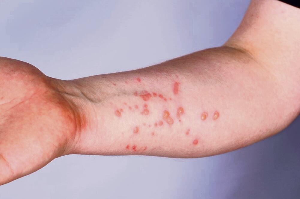 Foto: Especial/El Universal