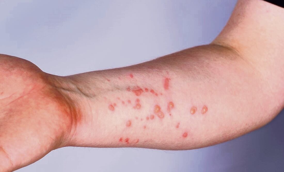 Foto: Especial/El Universal