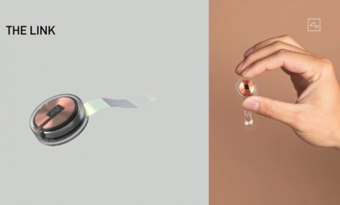 Los chips de Neuralink implantados son diminutos y transmiten señales en tiempo real