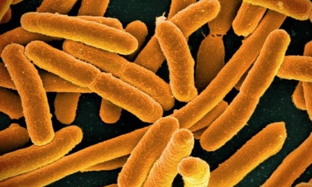 Bacterias carnívoras (imagen de referencia). FOTO: NATIONAL INSTITUTES OF HEALTH