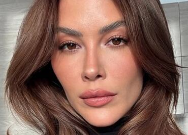 Michelle Salas enfrenta el melasma: ¿qué es y cómo le afecta este padecimiento?