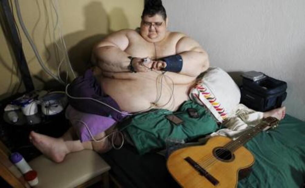 Juan Pedro no pesa 500 kilos, sino 590