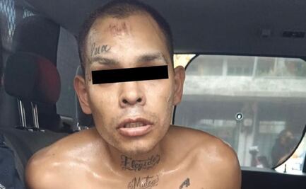 Detienen a hombre por prenderle fuego a su pareja sentimental; es acusado de tentativa de feminicidio
