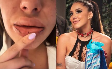 Isa, de "Acapulco Shore", exhibe que fue golpeada por su novio en un hotel