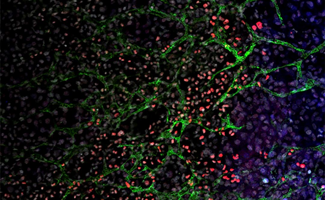 Foto: EFE/Centro Nacional de Investigaciones Oncológicas (CNIO)