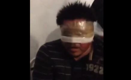 Video exhibe tortura a detenido por caso Ayotzinapa