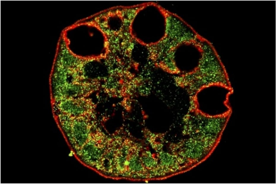 El Covid-19 puede afectar el tracto intestinal de algunas personas: estudio