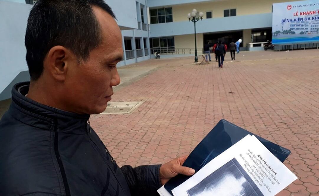 Nath vivió durante casi 20 años sin problemas de salud. (FOTO:EFE)