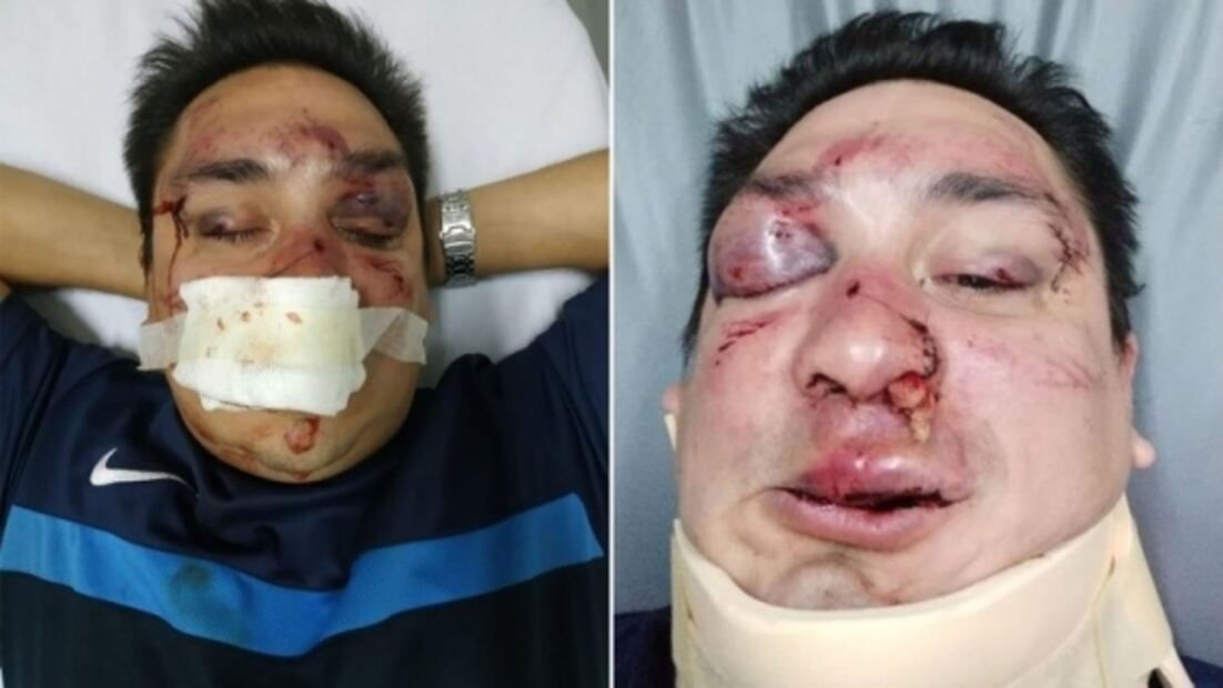Brutal agresión a periodista deportivo en Argentina