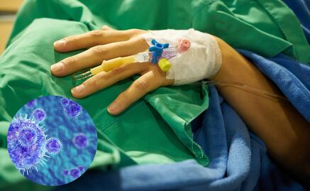 Muere hombre por presunto Metapneumovirus en Puebla; autoridades piden no alarmarse