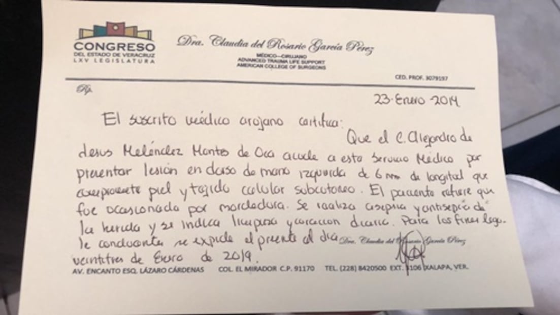 Diputada acusada de prepotente también mordió a un abogado y a una policía