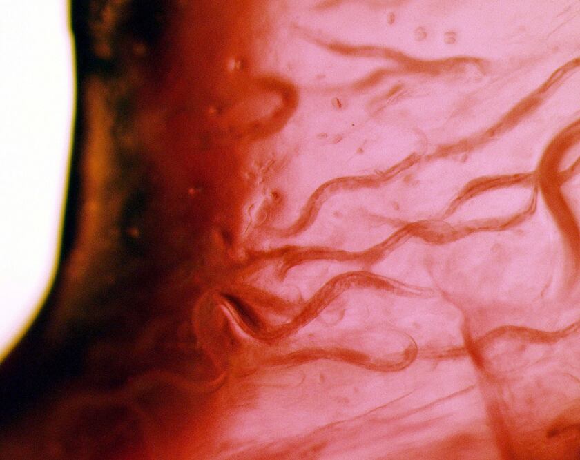 C. elegans nematodos. Foto: NASA / AFP, archivo 