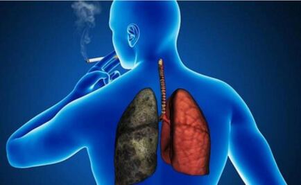 Con la estrategia del Caballo de Troya, luchan contra cáncer pulmonar